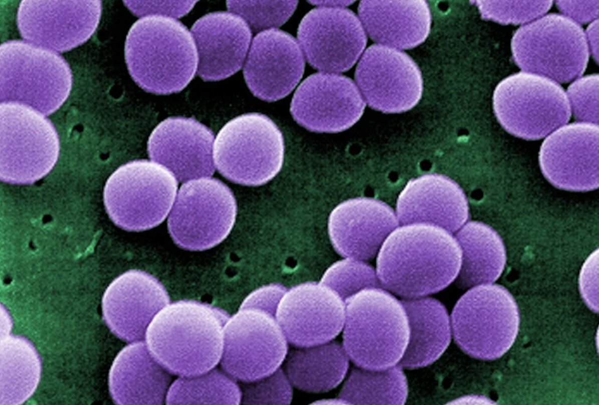 Yeni antimikrobiyal peptid mevcut antibiyotiklere dirençli suşları öldürüyor