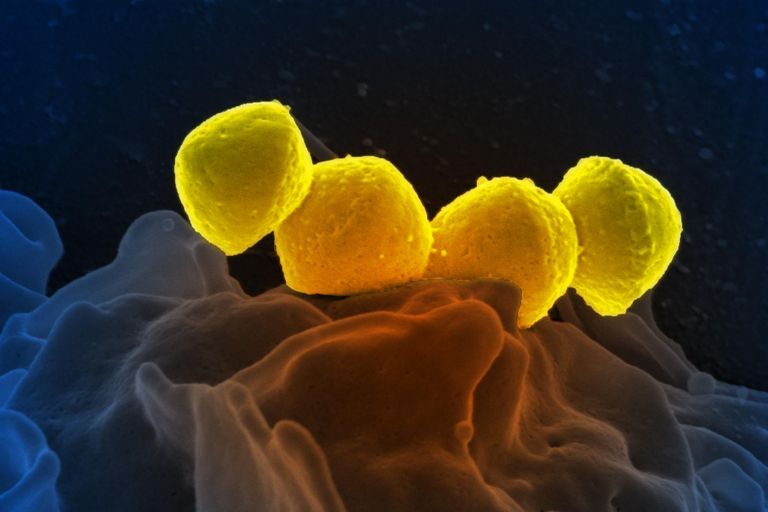 Bakterilerin Neden Olduğu 7 Korkunç Hastalık