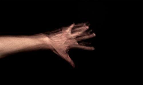 Yabancı El Sendromu (Alien Hand Syndrome) 